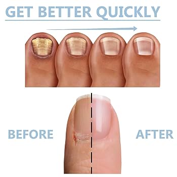 gid://shopify/MediaImage/27001963511878